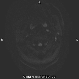 MRI Album 2 Pic 1